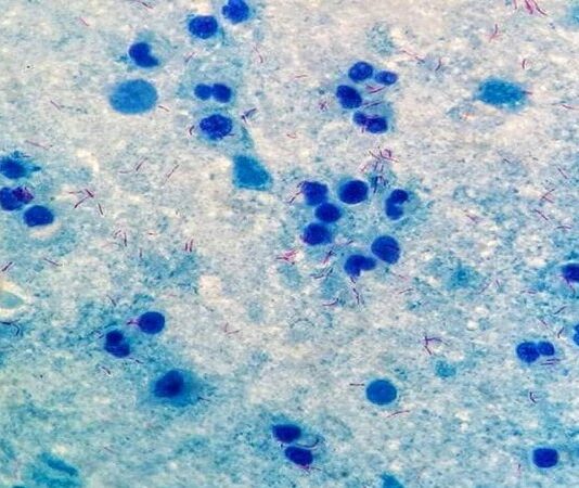UAE issues travel advisory against dangerous Marburg virus