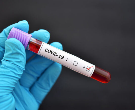 China prepares for new wave of covid cases from XBB variant, India issued warning
